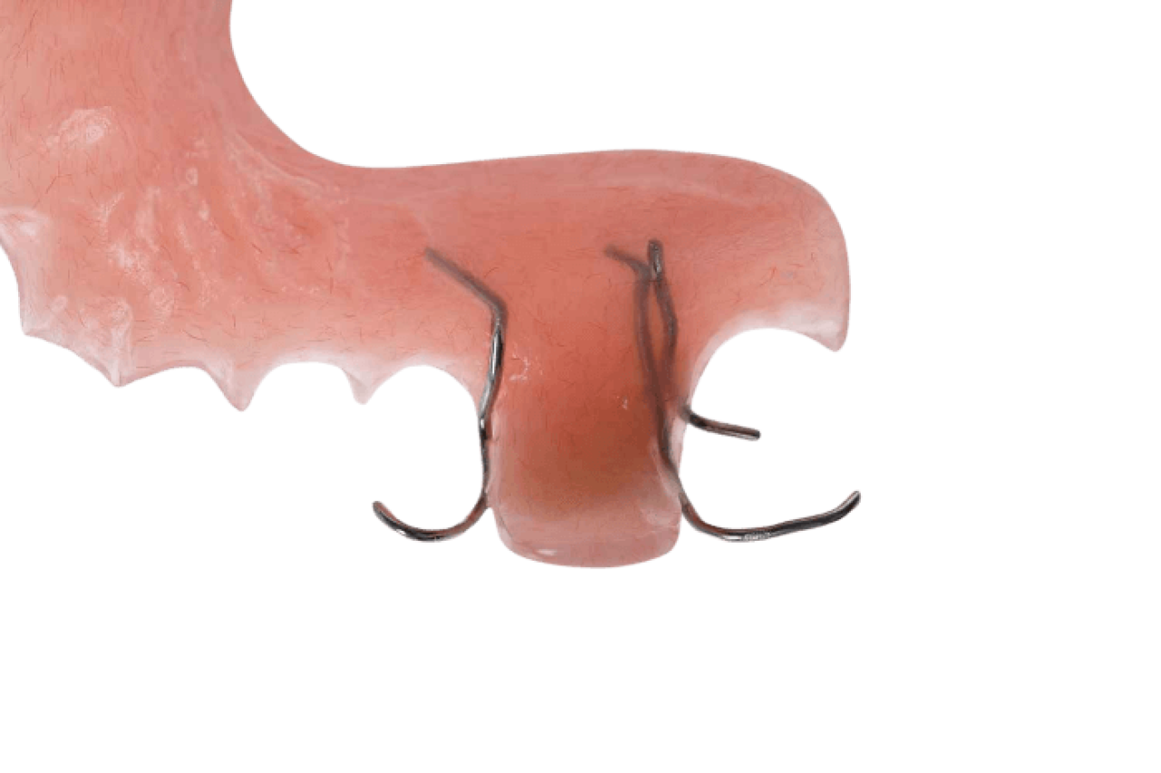 Partials Styles Acrylic Partial Dentures Guide & Cost | Northern Rivers